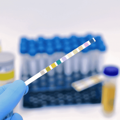 10P Urinalysis Test – 10-in-1 Parameter Urine Test